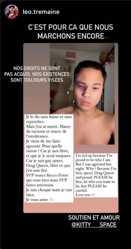 Kitty Space victime d'une agression homophobe à Paris