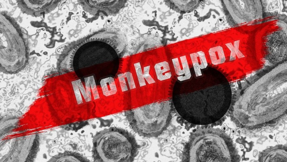 Variole du singe : la pandémie de mpox frappe l'Afrique et menace l'Europe